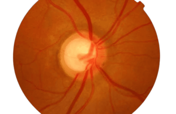 Prescription Glasses at FORST EYE CLINIC